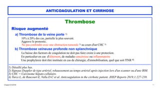 Claude EUGÈNE
ANTICOAGULATION ET CIRRHOSE
Thrombose


Risque augmenté




a) Thrombose de la veine porte 1)


10% à 20% des cas, partielle le plus souvent.


Aggrave le pronostic.
 
Ne pas confondre avec une obstruction tumorale 2) au cours d'un CHC 3)




b) Thrombose veineuse profonde non splanchnique


 
La baisse des facteurs de coagulation ne doit pas faire croire à une protection.


En particulier en cas d'alitement, de maladie cancéreuse ou inflammatoire
 
Une prophylaxie doit être instituée en cas de chirurgie, d'immobilisation, quel que soit l'INR 4)


........................................................................................................................................................................


1) Détaillé plus bas.


2) Signaux Doppler de type artériel, rehaussement au temps artériel après injection lors d'un scanner ou d'une IRM.


3) CHC = Carcinome hépato-cellulaire.


4) Turco L, de Raucourt E, Valla D-C et al. Anticoagulation in the cirrhotic patient. JHEP Reports 2019;1:227-239.
17
 
