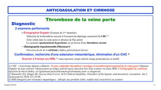 Claude EUGÈNE
ANTICOAGULATION ET CIRRHOSE
Thrombose de la veine porte


Diagnostic


2 examens performants


- Échographie Doppler (Examen de 1ère intention)
 
Détection de la thrombose souvent à l'occasion du dépistage semestriel du CHC 1)
 
Écho solide dans la veine porte et absence de flux portal
 
Le caractère spontanément hyperdense est en faveur d'une thrombose récente


- Élastographie impulsionnelle (Fibroscan*)


Détection facile de la cirrhose (chiffres généralement élevés)


Confirmation, recherche d'une extension mésentérique, élimination d'un CHC 2)


Scanner à 4 temps (ou IRM) 3) (sans injection, temps artériel, temps portal précoce et tardif)


......................................................................................................................................................................................................


1) CHC = Carcinome hépato-cellulaire. Ne pas confondre thrombose cruorique et envahissement tumoral de la veine porte (Signaux
Doppler de type artériel, rehaussement au temps artériel après injection lors d'un scanner ou d'une IRM. L'échographie de contraste,
injection de micro-bulles, est également particulièrement performante pour ce diagnostic.
 
2) Simonetto DA, Singal AK, Garcia-Tsao G et al. ACG Clinical Guideline: Disorders of the hepatic and mesenteric circulation. Am J
Gastroenterol 2020;115:18-40.


3) IRM (imagerie par résonance magnétique) : allergie aux produits iodés, nodule mal caractérisé au scanner.


24
 