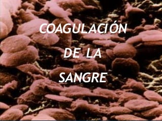 COAGULACIÓN
DE LA
SANGRE
 
