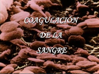 COAGULACIÓN  DE LA  SANGRE 