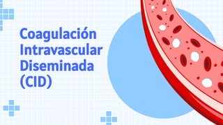 Coagulación
Intravascular
Diseminada
(CID)
 