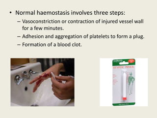 • Normal haemostasis involves three steps:
– Vasoconstriction or contraction of injured vessel wall
for a few minutes.
– Adhesion and aggregation of platelets to form a plug.
– Formation of a blood clot.
 