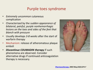 Purple toes syndrome
• Extremely uncommon cutaneous
complication
• Characterized by the sudden appearance of
bilateral, painful, purple nonhemorrhagic
lesions on the toes and sides of the feet that
blanch with pressure
• Usually develops 3-8 weeks after the start of
warfarin therapy
• Mechanism: release of atheromatous plaque
emboli
• Discontinue COUMADIN therapy if such
phenomena are observed. Consider
alternative drugs if continued anticoagulation
therapy is necessary.
Pharmacotherapy. 2003 May;23(5):674-7
 