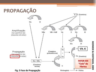 PROPAGAÇÃO
 PROPAGAÇÃO




                                            MONROE & HOFFMAN, 2009
                                Vit. K



                               FATOR XIII
                               “Cola” da
                                Fibrina
   Fig. 5 Fase de Propagação
 