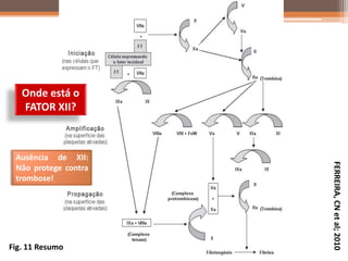 Onde está o
   FATOR XII?



 Ausência de XII:




                      FERREIRA, CN et al; 2010
 Não protege contra
 trombose!




Fig. 11 Resumo
 