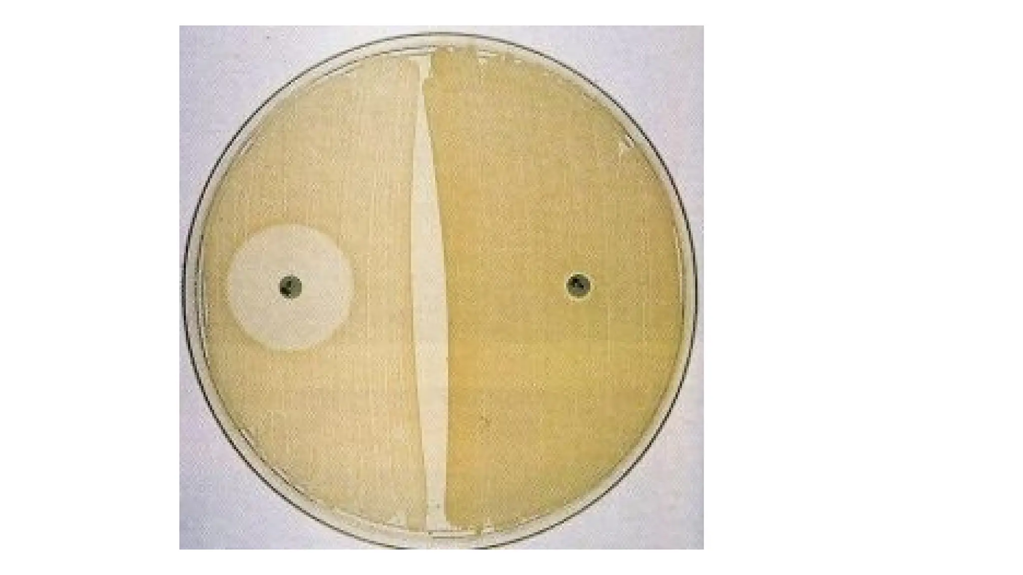 Coagulase negative staphylococcus aureus.pptx