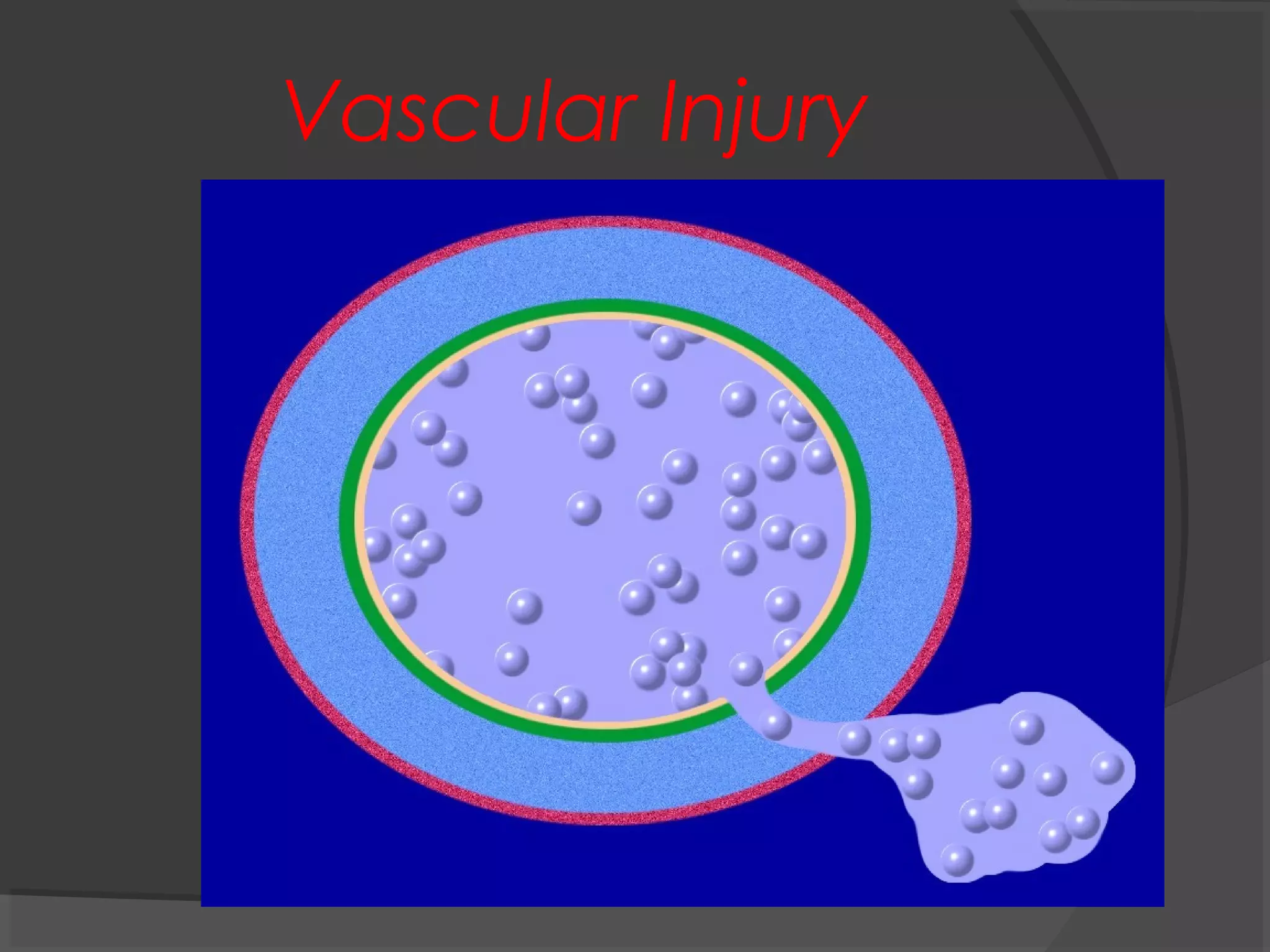 Vascular Injury
Damage
 