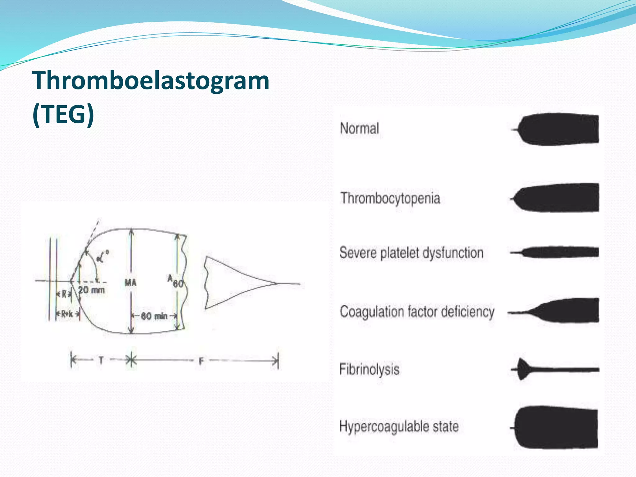 Thromboelastogram 
(TEG) 
 
