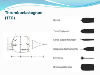 Thromboelastogram 
(TEG) 
 