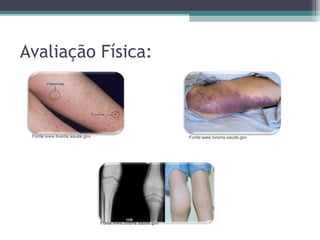 Avaliação Física:
Fonte:www.bvsms.saude.gov.
 