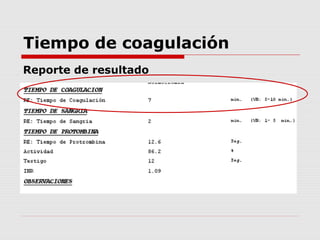 Tiempo de coagulación
Reporte de resultado
 
