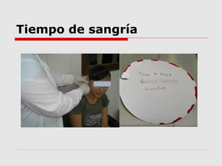 Tiempo de sangría
 