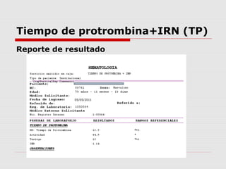 Tiempo de protrombina+IRN (TP)
Reporte de resultado
05/05/2011
 
