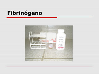 Fibrinógeno
 