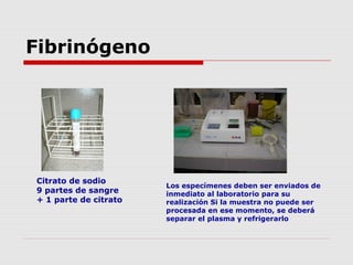 Fibrinógeno
Citrato de sodio
9 partes de sangre
+ 1 parte de citrato
Los especímenes deben ser enviados de
inmediato al laboratorio para su
realización Si la muestra no puede ser
procesada en ese momento, se deberá
separar el plasma y refrigerarlo
 