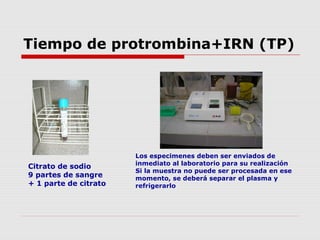 Tiempo de protrombina+IRN (TP)
Kit comercial de Tromboplastina
Reactivo liofilizado de
tromboplastina de cerebro de
conejo...