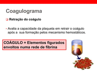 Coagulograma
 Retração do coágulo
• Avalia a capacidade da plaqueta em retrair o coágulo
após a sua formação pelos mecanismo hemostáticos.
COÁGULO = Elementos figurados
envoltos numa rede de fibrina
 