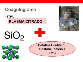 Coagulograma
• TTPA
PLASMA CITRADO
Cefalina+ celite ou
elastina+ cálcio +
37ºC
 