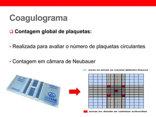 Coagulograma
 Contagem global de plaquetas:
• Realizada para avaliar o número de plaquetas circulantes
• Contagem em câmara de Neubauer
 