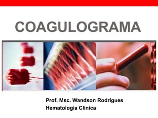 COAGULOGRAMA
Prof. Msc. Wandson Rodrigues
Hematologia Clínica
 