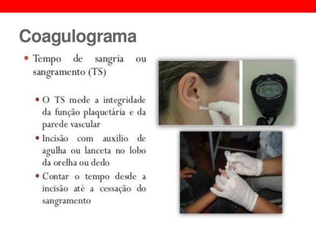Coagulograma