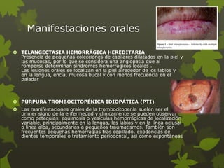 Manifestaciones orales
 TELANGECTASIA HEMORRÁGICA HEREDITARIA
Presencia de pequeñas colecciones de capilares dilatados en la piel y
las mucosas, por lo que se considera una angiopatía que al
romperse determinan síndromes hemorrágicos locales .
Las lesiones orales se localizan en la piel alrededor de los labios y
en la lengua, encía, mucosa bucal y con menos frecuencia en el
paladar
 PÚRPURA TROMBOCITOPÉNICA IDIOPÁTICA (PTI)
 Las manifestaciones orales de la trombocitopenia suelen ser el
primer signo de la enfermedad y clínicamente se pueden observar
como petequias, equimosis o vesículas hemorrágicas de localización
variable, principalmente en la lengua, los labios y en la línea oclusal
o línea alba, secundarias a pequeños traumatismos. También son
frecuentes pequeñas hemorragias tras cepillado, exodoncias de
dientes temporales o tratamiento periodontal, así como espontáneas
 