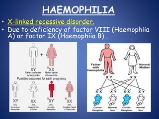 HAEMOPHILIA
• X-linked recessive disorder.
• Due to deficiency of factor VIII (Haemophiia
A) or factor IX (Haemophiia B) .
 