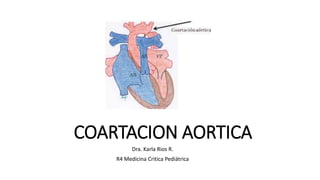 COARTACION AORTICA
Dra. Karla Rios R.
R4 Medicina Critica Pediátrica
 