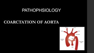 PATHOPHSIOLOGY
COARCTATION OF AORTA
 