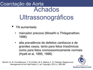 Achados
Ultrassonográficos
• TN aumentada:
• marcador precoce (Moselhi e Thilaganathan,
1996)
• alta prevalência de defeitos cardíacos e de
grandes vasos, tanto para fetos trissômicos
como para fetos cromossomicamente normais
(Hyett et al, 1995, 1996)
Bianchi, D. W. Cromblehome, T. M. D’Alton, M. E. Malone, F. D. Fetology: Diagosis and
Management of the Fetal Patient. 2. ed. Copyright, 2010. p. 364-368
Coarctação de Aorta
 