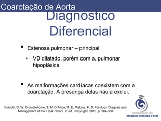 Diagnóstico
Diferencial
• Estenose pulmonar – principal
• VD dilatado, porém com a. pulmonar
hipoplásica
• As malformações cardíacas coexistem com a
coarctação. A presença delas não a exclui.
Bianchi, D. W. Cromblehome, T. M. D’Alton, M. E. Malone, F. D. Fetology: Diagosis and
Management of the Fetal Patient. 2. ed. Copyright, 2010. p. 364-368
Coarctação de Aorta
 