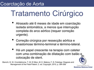 Tratamento Cirúrgico
• Atrasado até 6 meses de idade em coarctação
isolada sintomática, a menos que interrupção
completa do arco aórtico (requer correção
urgente).
• Correção cirúrgica por ressecção aórtica e
anastomose término-terminal e término-lateral.
• Há um papel crescente na terapia com cateter
com uma combinação de dilatação com balão e
colocação de stent.
Bianchi, D. W. Cromblehome, T. M. D’Alton, M. E. Malone, F. D. Fetology: Diagosis and
Management of the Fetal Patient. 2. ed. Copyright, 2010. p. 364-368
Coarctação de Aorta
 