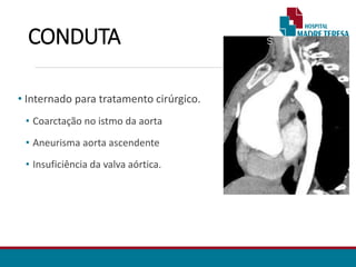 CONDUTA
• Internado para tratamento cirúrgico.
• Coarctação no istmo da aorta
• Aneurisma aorta ascendente
• Insuficiência da valva aórtica.
 