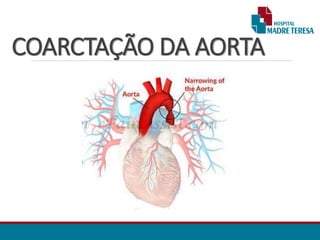COARCTAÇÃO DA AORTA
 