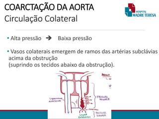 COARCTAÇÃO DA AORTA
Circulação Colateral
• Alta pressão  Baixa pressão
• Vasos colaterais emergem de ramos das artérias subclávias
acima da obstrução
(suprindo os tecidos abaixo da obstrução).
 