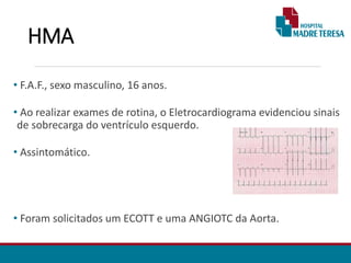 HMA
• F.A.F., sexo masculino, 16 anos.
• Ao realizar exames de rotina, o Eletrocardiograma evidenciou sinais
de sobrecarga do ventrículo esquerdo.
• Assintomático.
• Foram solicitados um ECOTT e uma ANGIOTC da Aorta.
 