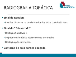 RADIOGRAFIA TORÁCICA
• Sinal de Roesler:
• Erosões bilaterais na borda inferior dos arcos costais (3ª - 9ª).
• Sinal do “ 3 invertido”
• Dilatação Subclávia E.
• Segmento estenótico aparece como um entalhe
• Dilatação pós estenótica.
• Contorno do arco aórtico apagado.
 