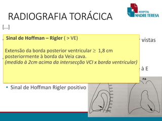 [...]
• Dilatação das artérias mamárias internas podem ser vistas
no perfil como densidade de partes moles.
• Aumento do Ventrículo Esquerdo
• Ápice cardíaco se projeta inferiormente e lateralmente à E
• Abaulamento margem cardíaca
• Sinal de Hoffman Rigler positivo
RADIOGRAFIA TORÁCICA
Sinal de Hoffman – Rigler ( > VE)
Extensão da borda posterior ventricular  1,8 cm
posteriormente à borda da Veia cava.
(medido à 2cm acima da intersecção VCI x borda ventricular)
 