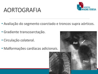 AORTOGRAFIA
• Avaliação do segmento coarctado e troncos supra aórticos.
• Gradiente transcoarctação.
• Circulação colateral.
• Malformações cardíacas adicionais.
 