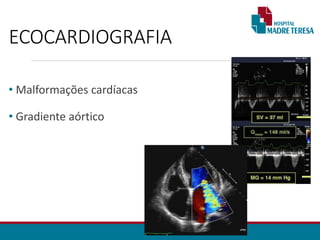 ECOCARDIOGRAFIA
• Malformações cardíacas
• Gradiente aórtico
 