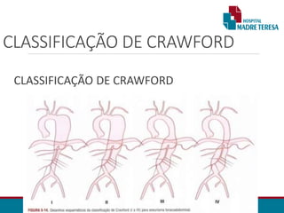 CLASSIFICAÇÃO DE CRAWFORD
CLASSIFICAÇÃO DE CRAWFORD
 