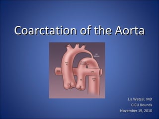 Coarctation of the AortaCoarctation of the Aorta
Liz Wetzel, MDLiz Wetzel, MD
CICU RoundsCICU Rounds
November 19, 2010November 19, 2010
 
