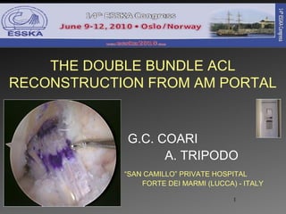 G.C. COARI  A. TRIPODO  THE DOUBLE BUNDLE ACL RECONSTRUCTION FROM AM PORTAL “ SAN CAMILLO” PRIVATE HOSPITAL  FORTE DEI MARMI (LUCCA) - ITALY 