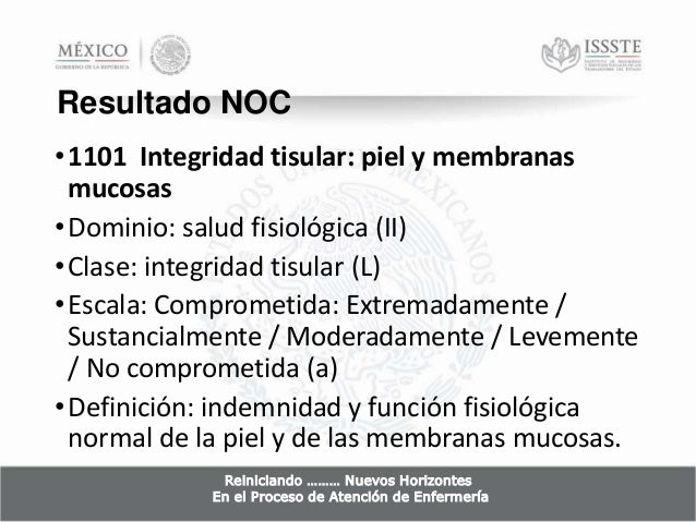 Coartacion aortica