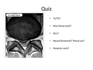 T2 Disc how to read spine mri | PPTX