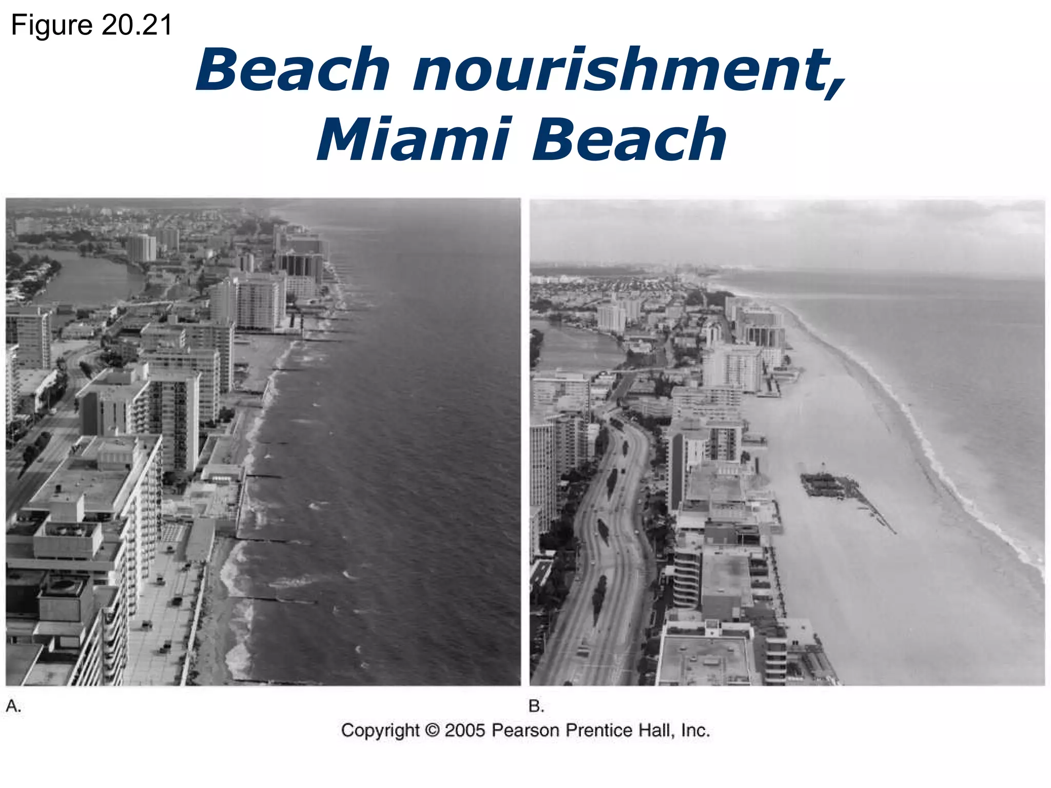 Figure 20.21 Beach nourishment, Miami Beach 