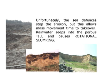 Unfortunately, the sea defences
stop the erosion, but this allows
mass movement time to takeover.
Rainwater seeps into the porous
TILL and causes ROTATIONAL
SLUMPING.
 