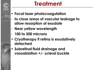 Treatment Focal laser photocoagulation  to close areas of vascular leakage to allow resorption of exudate Near yellow wavelength 100 to 500 microns Cryotherapy if retina is exudatively detached Subretinal fluid drainage and vasoablation +/- scleral buckle 