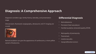 Diagnosis: A Comprehensive Approach
Diagnosis considers age, family history, laterality, and presentation
stage.
Clinical exam, fluorescein angiography, ultrasound, and CT imaging are
crucial.
Retinal exudation can give the appearance of xanthocoria, a more yellow
variant of leukocoria.
Differential Diagnosis
• Retinoblastoma
• Persistent fetal vasculature
• Familial exudative vitreoretinopathy (FEVR)
• Retinopathy of prematurity
• Toxocariasis
• Uveitis/vasculitis
• Vasoproliferative tumors
 