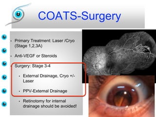 COATS-Surgery
• Primary Treatment: Laser /Cryo
(Stage 1,2,3A)
• Anti-VEGF or Steroids
• Surgery: Stage 3-4
• External Drainage, Cryo +/-
Laser
• PPV-External Drainage
• Retinotomy for internal
drainage should be avoided!
 